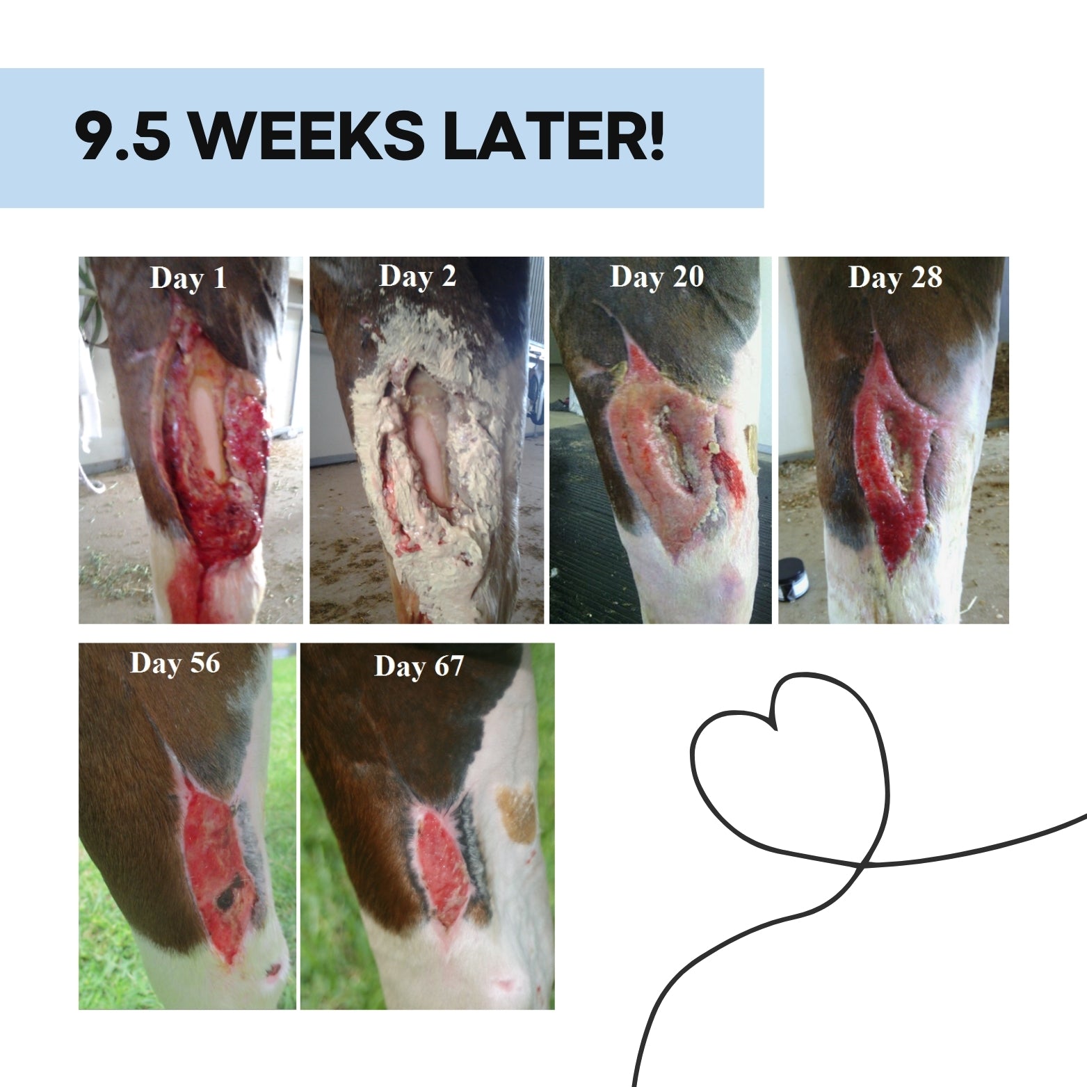 Severe Wound Care Kit